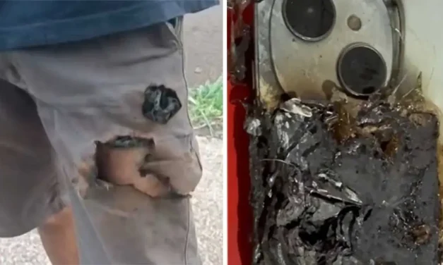 Ledakan Ponsel Di Saku Selamatkan Pria Dari Serangan Anjing