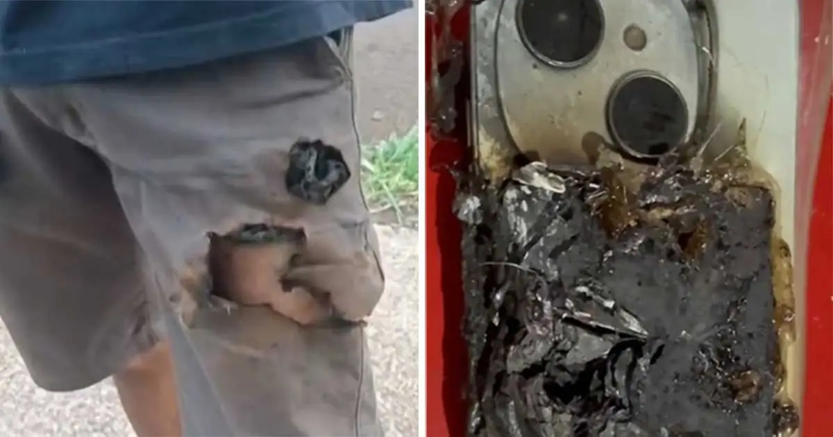 Ledakan Ponsel Di Saku Selamatkan Pria Dari Serangan Anjing